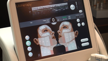 Ultrasound Imaging for Ultherapy